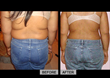 Diet Doc Announces their Updated and Modern Approach to Weight Loss as...