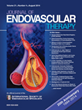 Drug-Eluting Balloon Angioplasty Shows Excellent Results for...