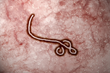 New Jersey Law Firm Handling Ebola and Employment Related Issues in...