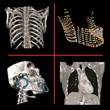 Stratovan Corporation&#39;s Checkpoint Software Delivers Better Shape Analysis of 3D Medical Images