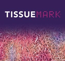 TissueMark tumourmap img