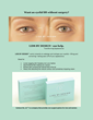 Want an eyelid lift without surgery?