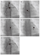 Okayama University research: Cell injections get to the heart of...