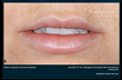 Your smile can be impacted by unsightly wrinkles and lines, but Dr. F....
