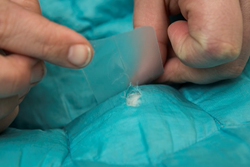 down jacket repair, puffer jackets, repair patch, tenacious tape, tenacious tape mini