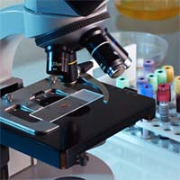 Mesothelioma Diagnosis and the Cell Block Method