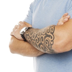 Texas, cosmetic surgeon, cosmetic surgery, laser, injectables, tattoo removal Dallas, tattoo removal, tattooed, tattoo art, tattoo studio, tattoo regret, tattoo wrist, tattoo lightening, Apple Watch, Apple computer, pulse sensor, PicoSure, Adelglass, Skin