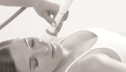 Pollogen LEGEND for effective micro-needle RF technology without pain or downtime