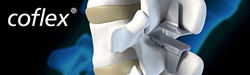 coflex® Interlaminar Technology