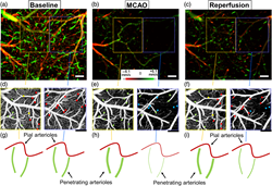OCT, widely used in ophthalmology and other medical fields, holds potential to reveal how blood flows in the brain during stroke, (© Credit: Ruikang Wang et al.)