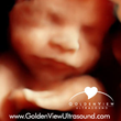 HD LIVE Ultrasound at GoldenView Ultrasound Boston Provides Realistic View of Baby in the Womb
