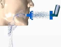 Simulation Significantly Impacts Respiratory Systems Device Design By Reducing Clinical Trial Tests