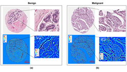 Figure 3 from a new article in the Journal of Biomedical Optics compares stained bright-field microscopy (top row) and SLIM (bottom row) images; doi:10.1117/1.JBO.20.11.111210