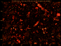 Restored Trafficking of Parkinson's Protein