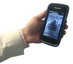 Clearview Diagnostics cCAD* Computer Assistant Demonstrated on Honeywell's Dolphin CT50h