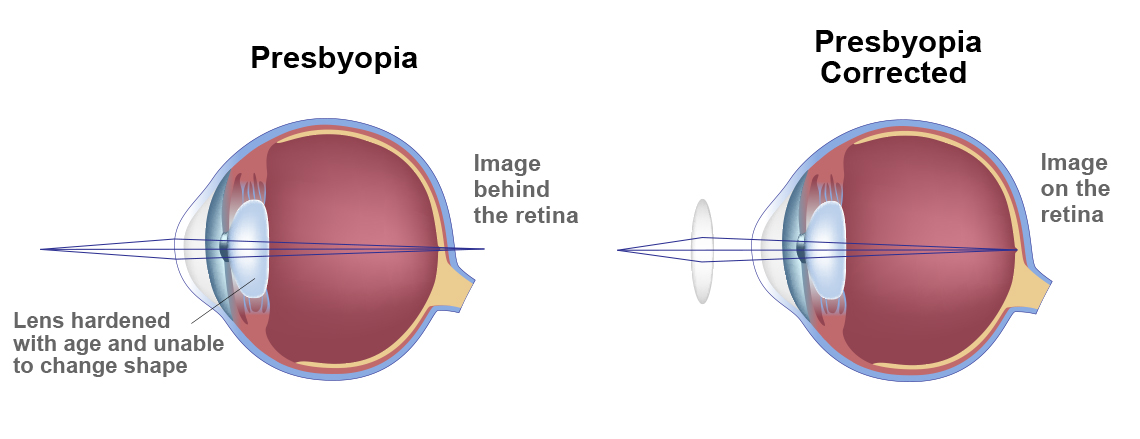 Dr. Andrew Holzman Offers a New Treatment, the KAMRA