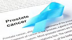 Prostate Cancer Detection; Prostate Cancer; Prostate Cancer Tests;