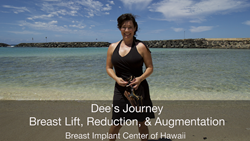 Breast Lift, Breast Reduction, Breast Augmentation