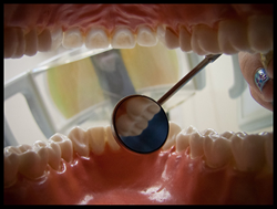 Bay Area Dental Implants