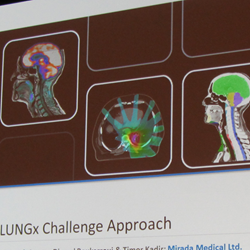 Results from the PROSTATEx Challenge will be presented at SPIE Medical Imaging 2017, following on the LUNGx Challenge of 2015 (above).