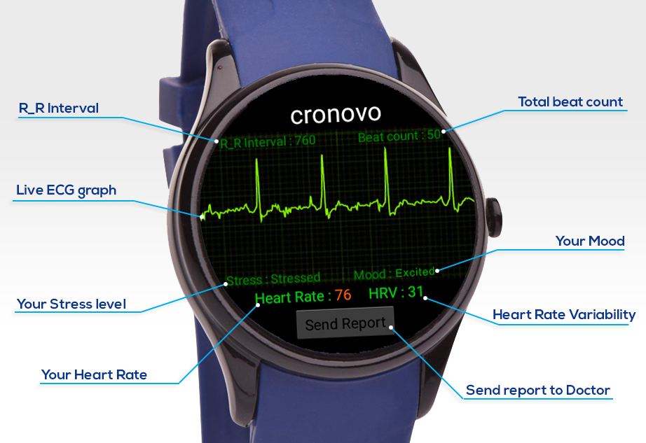 ekg smartwatch