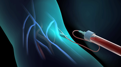 Triglycerides-animation