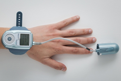 Itamar Medical WatchPAT