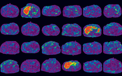 MR Elastography liver