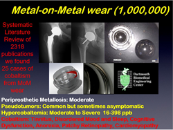 Metal on Metal Hip Implants at Risk for Leaching Cobalt Into the Blood Stream