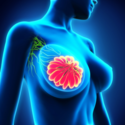The breast cancer root canal connection.