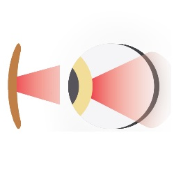 Diagram of Sunlight-Powered PBM Device