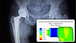 Beneficial Compression Imparted with LPB
