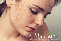 Freckles are in the spotlight with Meghan Markle embracing hers. For those who don’t love them, we offer a range of laser and light options that reduce unwanted brown pigment without much downtime.