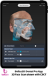 Bellus3D Announces Dental Pro 3D Face Scanning App