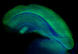 Brain Tissue Clearing and 3D Imaging Services