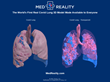 Thyng Announces the World’s First Public Release of a 3D Model Showing Real Lungs Severely Damaged by Covid