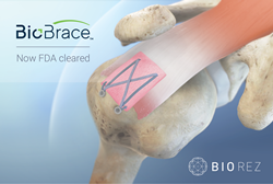 Biorez Announces FDA 510(k) Clearance of Its Proprietary BioBrace™ Implant  Technology