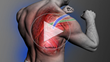 Healthclick introduces new continuing education to enhance the ability of physical and occupational therapists to identify and treat shoulder dysfunction