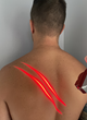 FDA Grants 510(k) Market Clearance for Whole Body Postoperative Pain to World Leader in Low Level Laser Technology