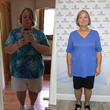 Options Medical Weight Loss™ Clinic Helps St. Petersburg Woman Lose More Than 90lbs