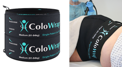 ColoWrap Anti-Looping Colonoscopy Compression Device