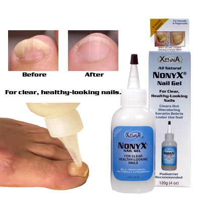 Top Sports Performance Requires Keeping Hands and Feet in Shape: Natural  Skin and Nail Care Products from Xenna Help Athletes Look and Feel Better