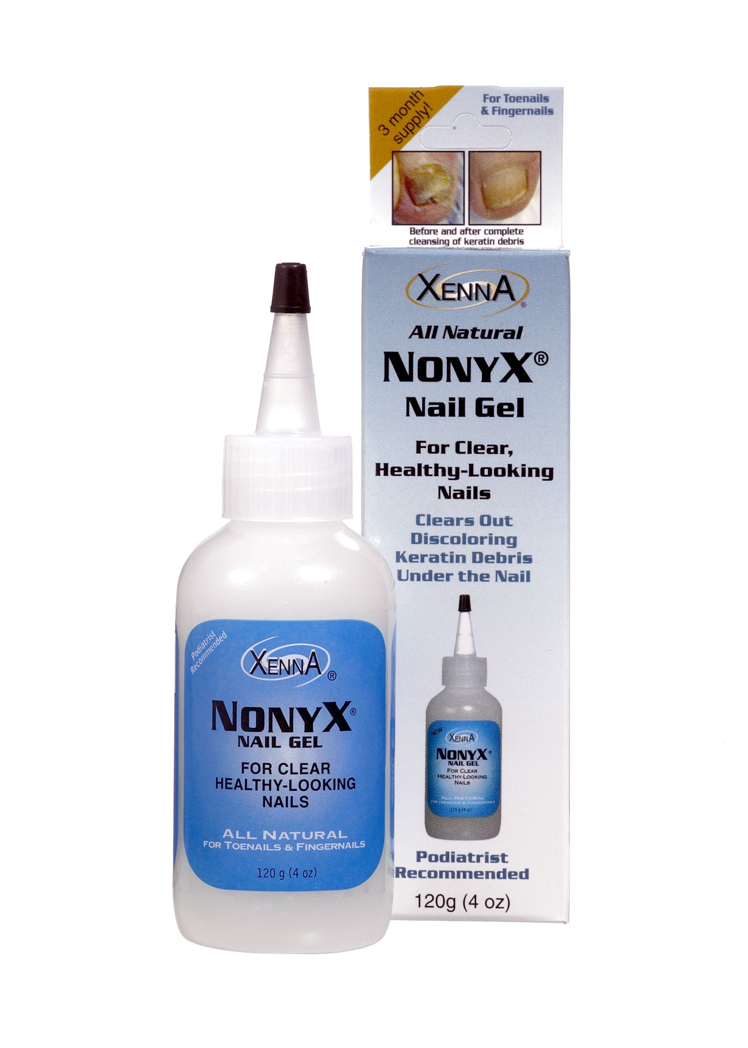 nonyx-nail-gel-a-toenail-fungus-treatment-that-clears-out-fungus-by