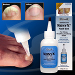 NonyX Nail Gel for Clear, Healthy-Looking Nails