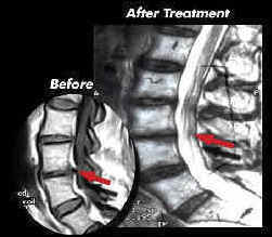 mri.jpg