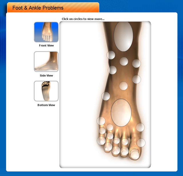 Foot Doctor in Houston Texas launches informative, patient friendly ...