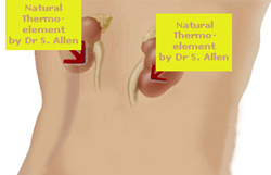 Thermoelement by Dr. Allen close to kidneys