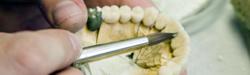 Dental lab crown, bridge and implant restorations