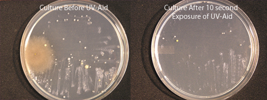 Bacterial Colony Comparison Before and After UV-Aid Treatment