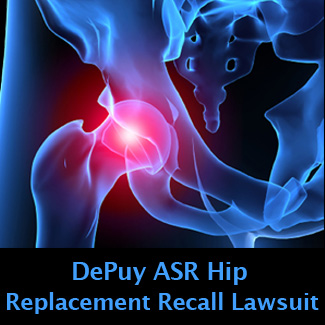 DePuy ASR Hip Replacement Recall Lawyers at Wright & Schulte LLC ...